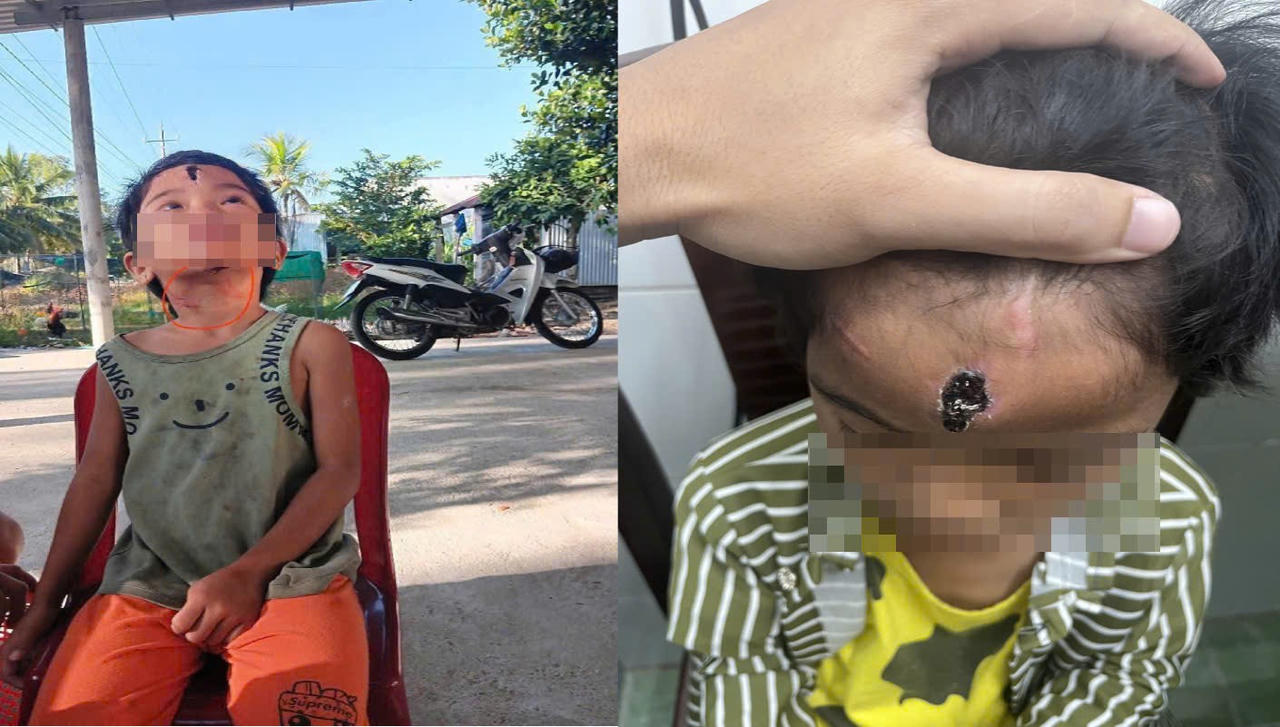 Khởi tố 'cha dượng' hành hạ con riêng của vợ 