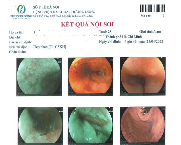 Bệnh viện Phương Đông: Điều trị sớm cho bệnh nhân phát hiện ung thư thực quản nhờ khám tổng quát 