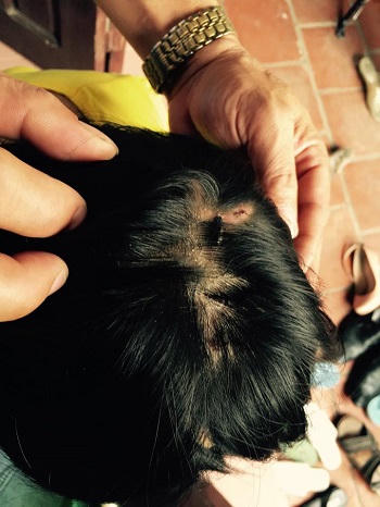 Nghe nhân chứng và bị hại thuật lại quá trình giải thoát cháu bé ở Hưng Yên