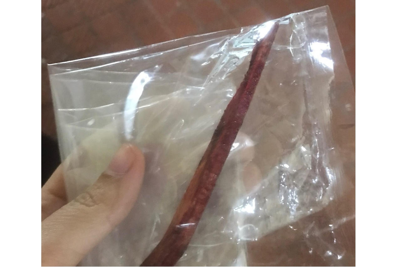 Cứu sống người đàn ông bị mảnh gỗ đâm thủng động mạch cổ