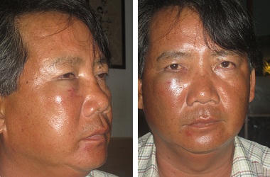 Nghi án quản lý đô thị hành hung người dân, bắt đưa lên xe thùng?