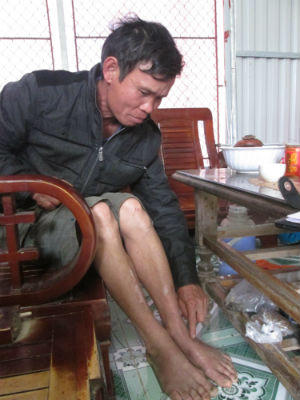 Hải Dương: Công an huyện cùm chân, ép cung bác nông dân vô tội?