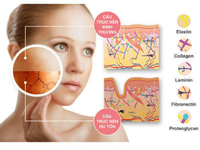 Ánh nắng mặt trời - “kẻ hủy diệt” nguy hiểm nhất với làn da phái đẹp