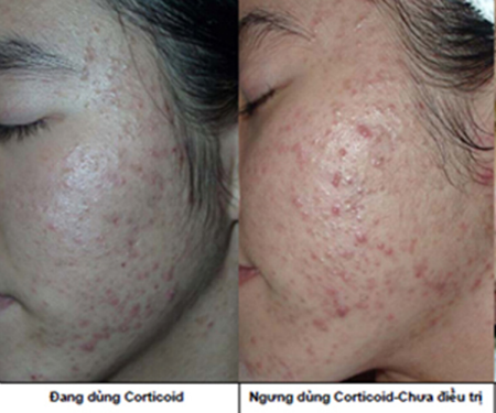 Đừng ham mỹ phẩm giá rẻ