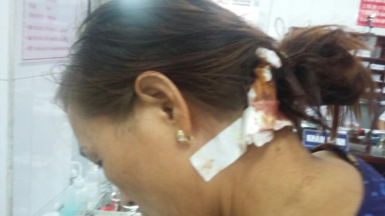 Phú Quốc: Vì sao kẻ chém người vẫn nhởn nhơ ngoài vòng pháp luật?