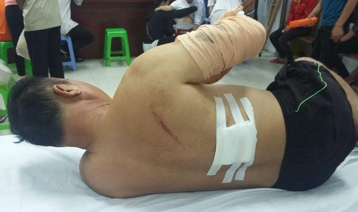 Phú Quốc: Vì sao kẻ chém người vẫn nhởn nhơ ngoài vòng pháp luật?