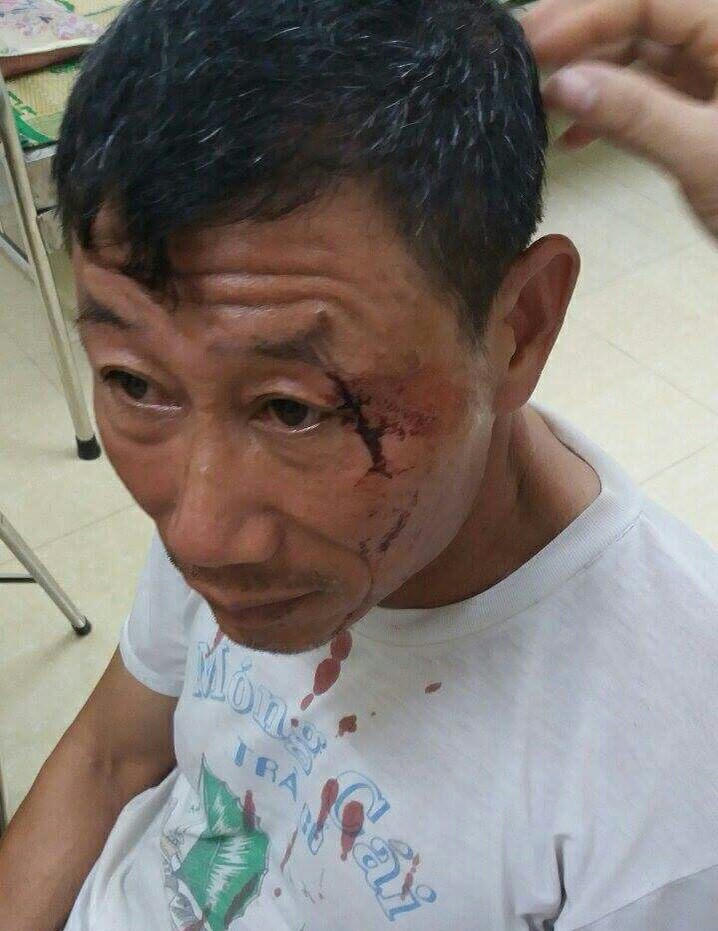 Thanh Thủy, Phú Thọ: Cần sớm làm rõ vụ việc nhóm côn đồ “đại náo” vùng quê