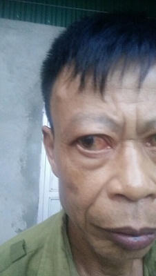 “Gây thương tích 36% nhưng lại được hưởng án treo”: Nhiều dấu hiệu của việc bỏ lọt tội phạm!?