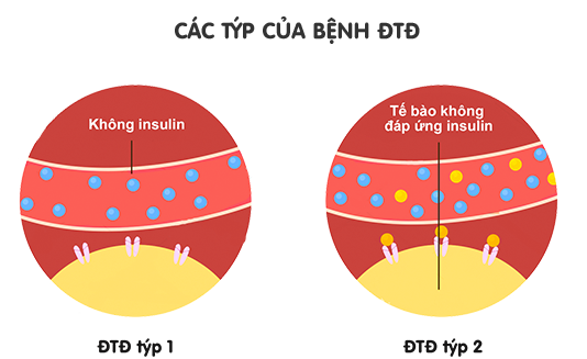 Chế độ ăn uống và bệnh đái tháo đường
