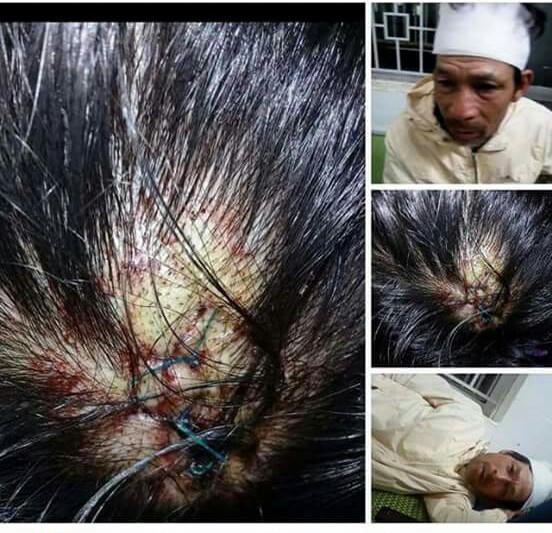 Quảng Ngãi: Phó Bí thư Đảng ủy xã bị “tố” hành hung dân phải nhập viện