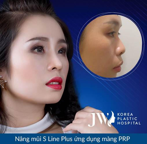 Nổi bật những ca mũi khó được giải cứu 2018