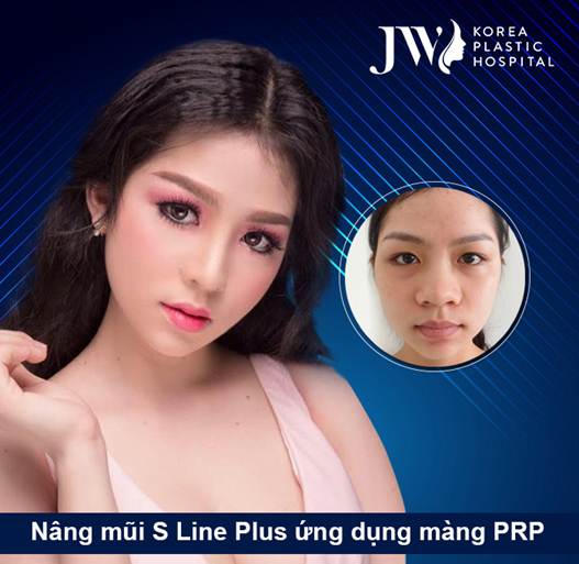 Nổi bật những ca mũi khó được giải cứu 2018