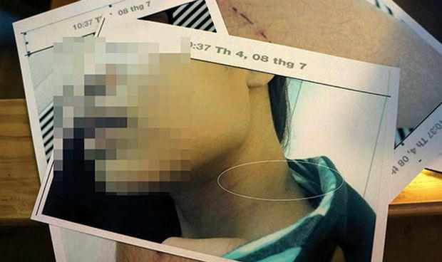 Vụ án hiếp dâm xảy ra tại quận 7: KSV “tham mưu” sai, vẫn được giao kiểm sát vụ án