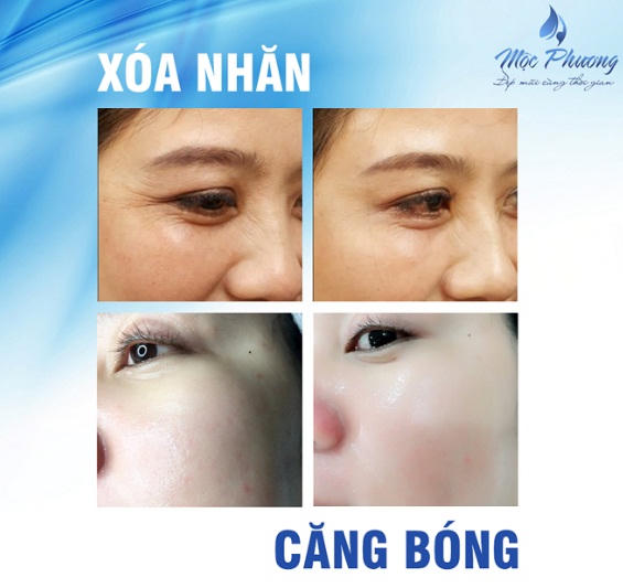 Mộc Phương Beauty & Clinic: Vinh dự đón nhận ngôi sao thẩm mỹ quốc tế xu hướng 4.0