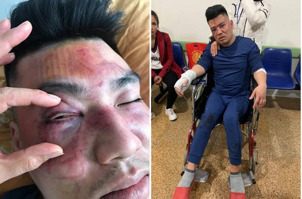 Nghi án nhân viên giao hàng bị đối tượng “bảo kê” hành hung?