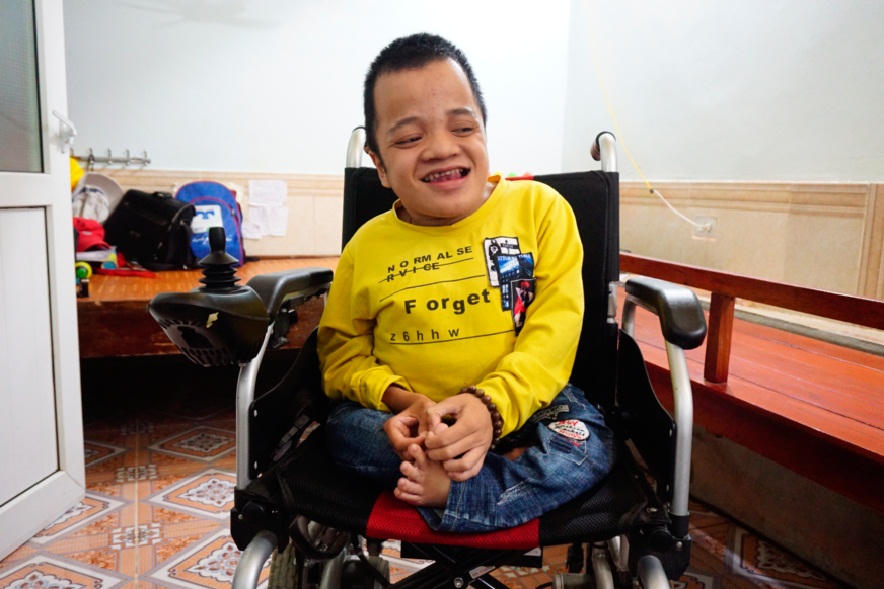 Hành trình vượt lên số phận của hai anh em xương thủy tinh