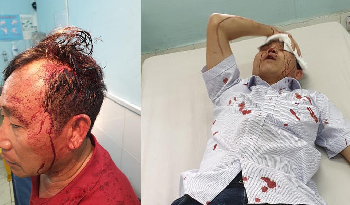 Đánh hai người nhập viện, còn gọi điện thách thức nạn nhân