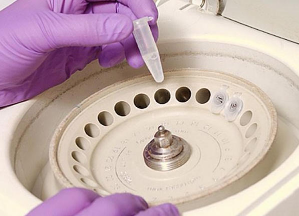 Xét nghiệm ADN những điều bạn chưa biết