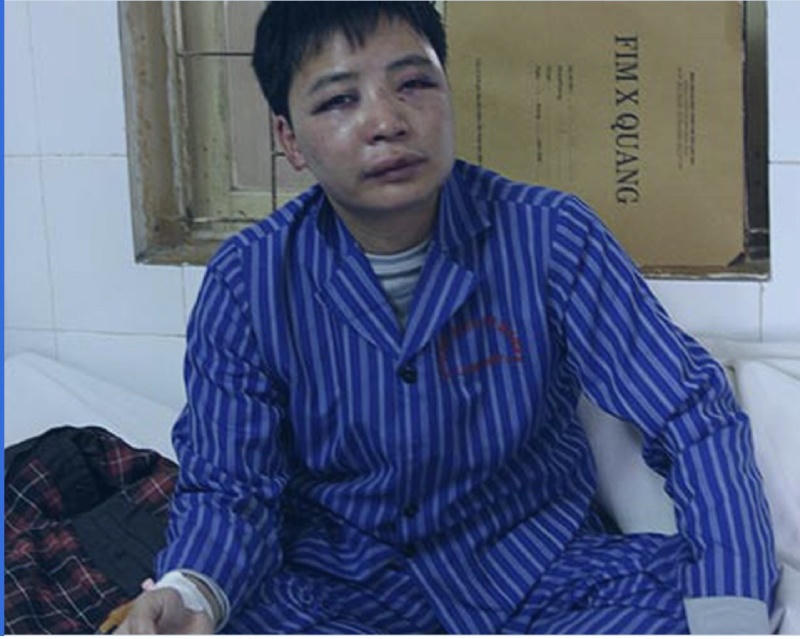 Nhà báo, phóng viên bị cản trở, xúc phạm khi tác nghiệp: 'Chuyện thường ở huyện'