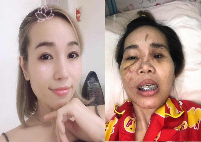 Vụ TNGT làm hai người chết ở Bà Rịa -  Vũng Tàu: Nạn nhân kiến nghị xem xét trách nhiệm người mượn xe