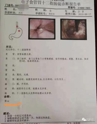 Cô gái 21 tuổi đã bị ung thư, bác sĩ cảnh báo thói quen xấu ở giới trẻ