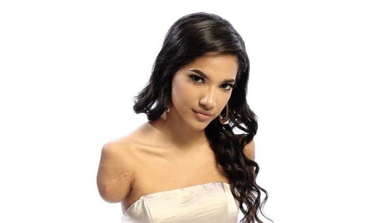 Thí sinh cụt hai tay thi Miss Ecuador