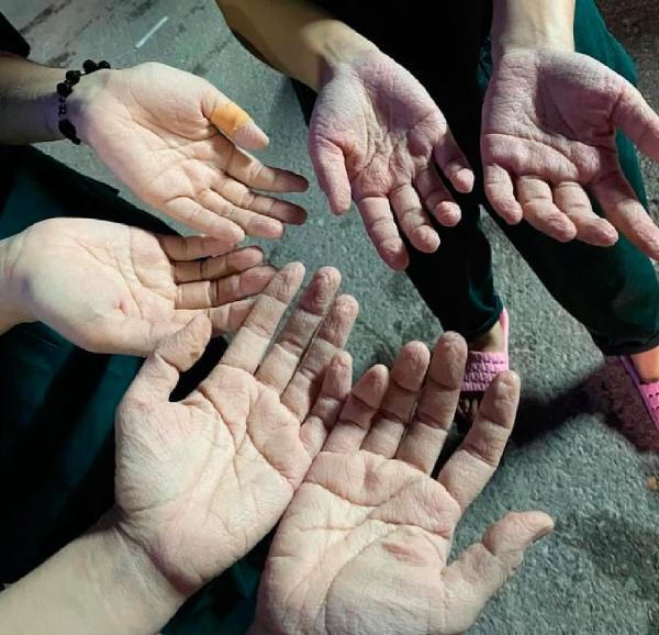 Chuyện kể từ đôi bàn tay