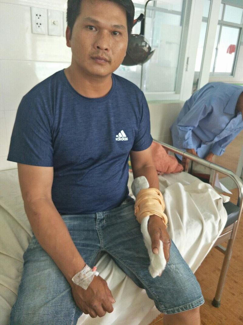 Tiếp bài “bất thường trong xử lý nghi án “cố ý gây thương tích””: Công an huyện Bảo Lâm kết luận ra sao?