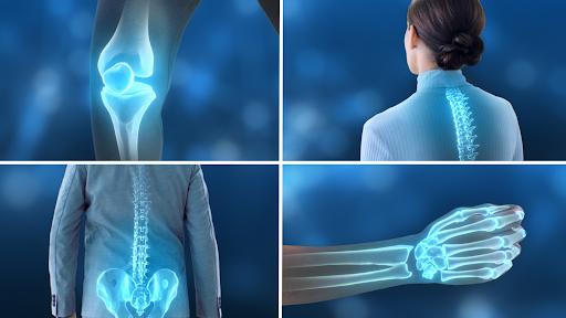 Rối loạn miễn dịch, bão cytokine khiến xương khớp đau nhức