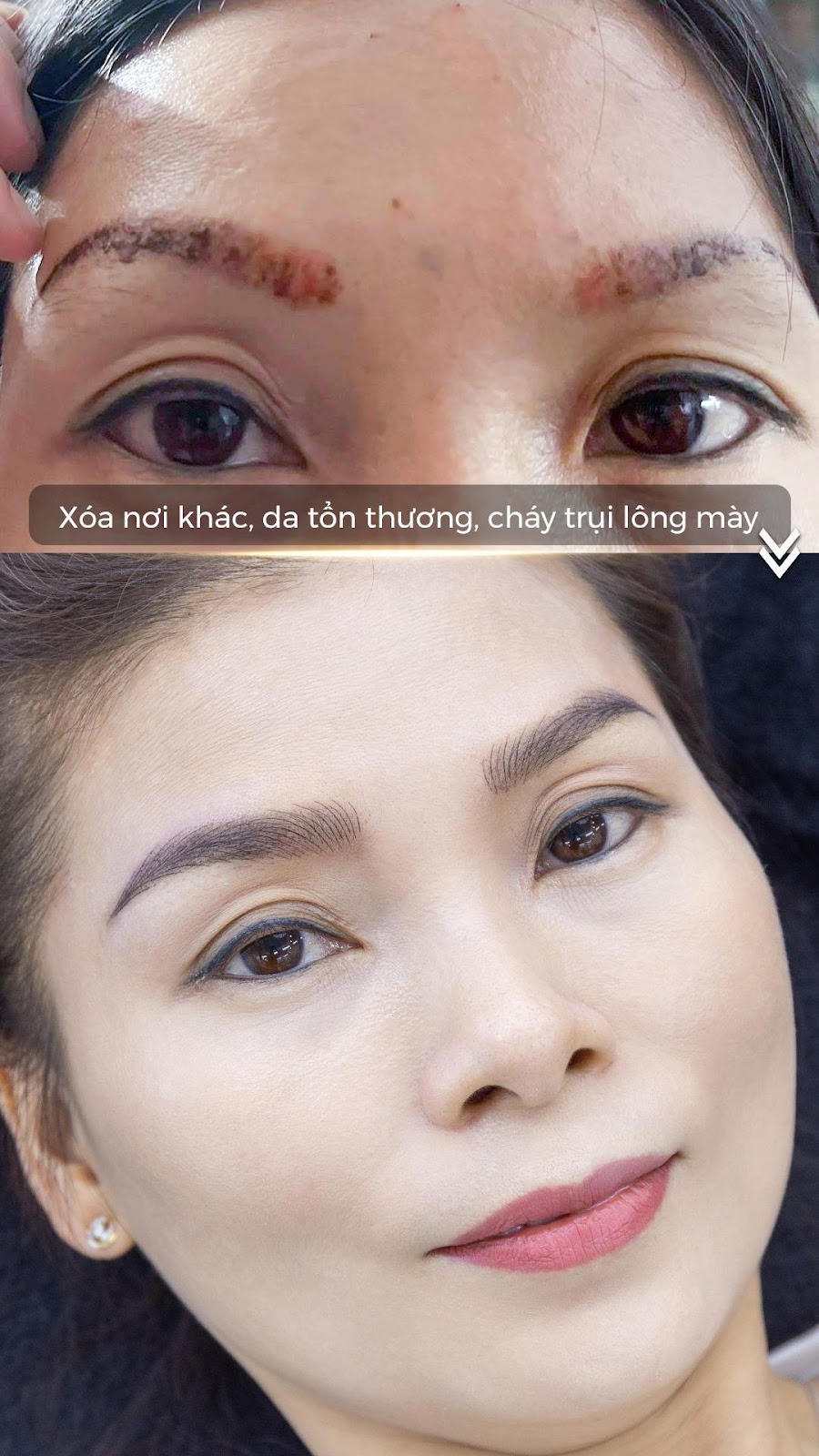 Master Ngoan Minh Vương: Phun xăm thẩm mỹ hiệu quả nhưng đừng chủ quan