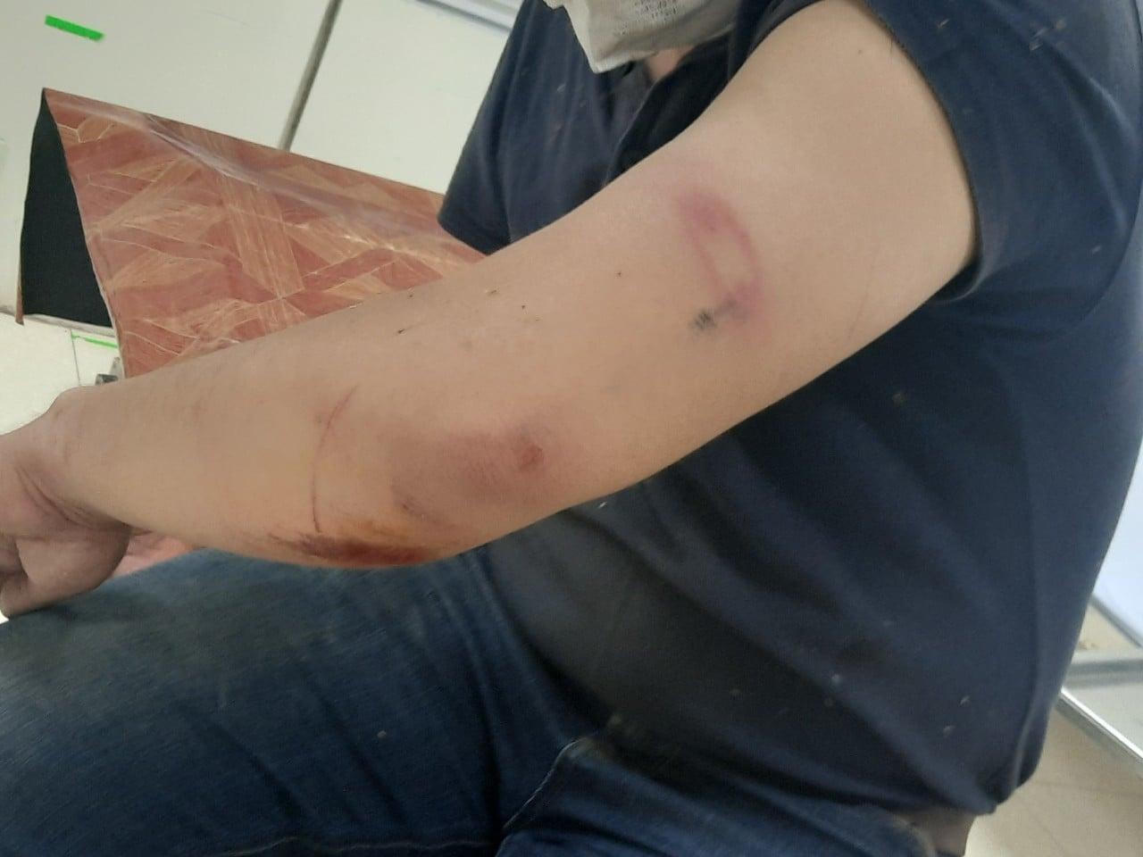 Công an xác minh vụ phóng viên bị hành hung