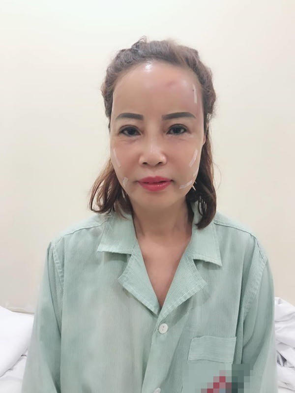 Cô dâu 62 tuổi chi thêm hàng trăm triệu chỉnh trang nhan sắc