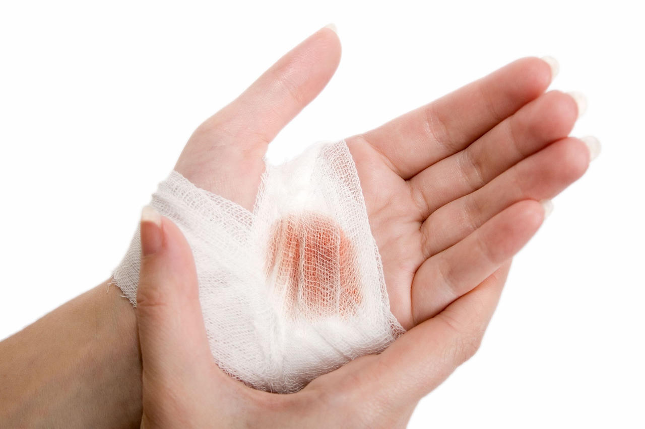 Cách sơ cứu chó cắn để không mắc bệnh dại