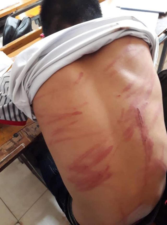 Điều tra vụ nam sinh lớp 8 bị bố đẻ đánh đập dã man 