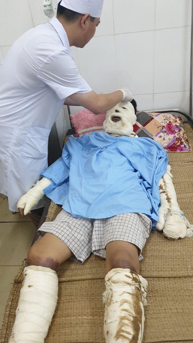  ​Bình ga nổ trong đám tang, 5 người nhập viện 