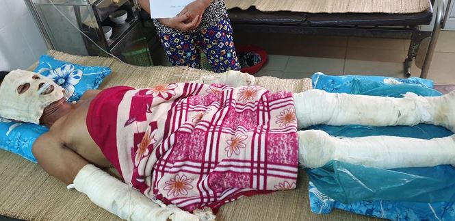  ​Bình ga nổ trong đám tang, 5 người nhập viện 