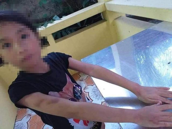 Bé gái 9 tuổi bị cô giáo dạy thêm đánh bầm mặt 