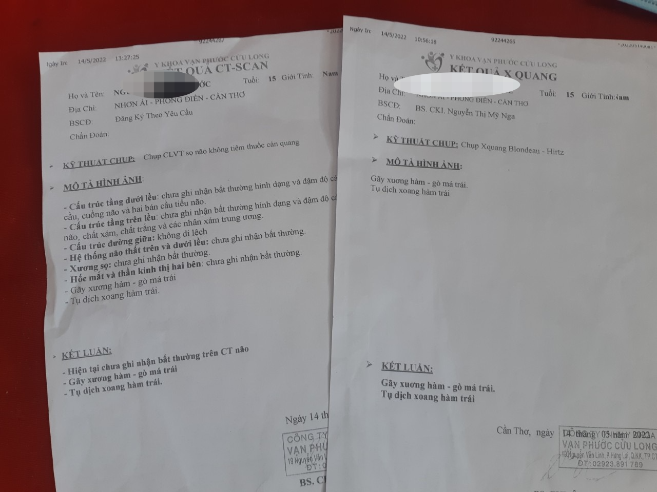 Nam sinh lớp 9 ở Cần Thơ bị bảo vệ trường đánh gãy xương hàm