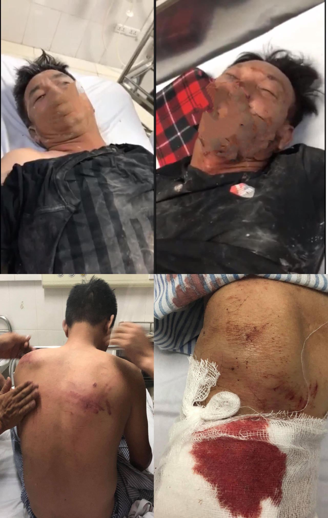 Vụ “Cố ý gây thương tích” ở Đông Triều (Quảng Ninh): Công an không nên ‘đẩy bóng’ về phía Viện Kiểm sát?