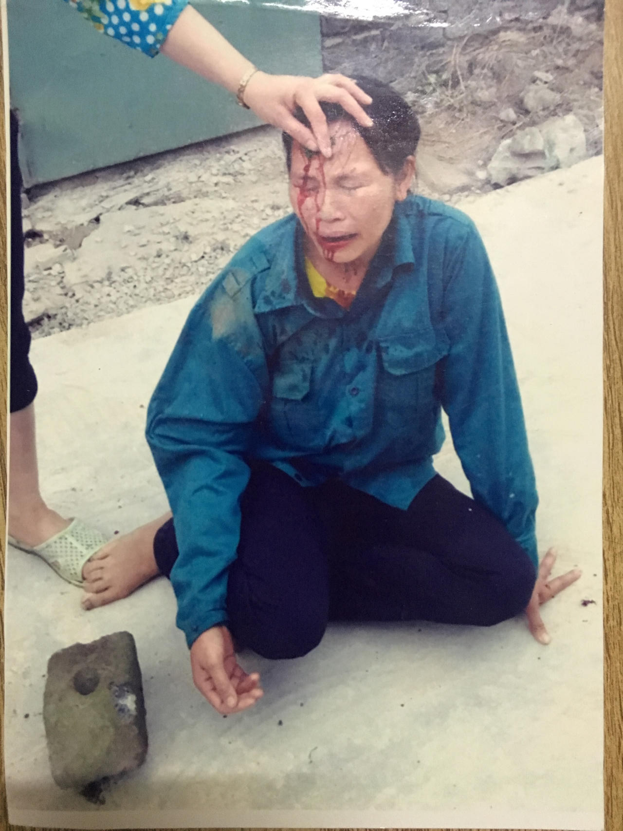 Hải Dương:  Đập gạch vào đầu hàng xóm chỉ vì cây dừa