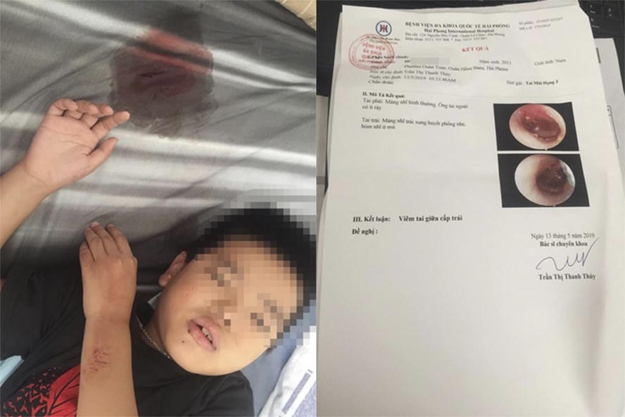 Cô giáo đánh loạt học sinh tại Hải Phòng: Công an đề xuất hình thức xử lý