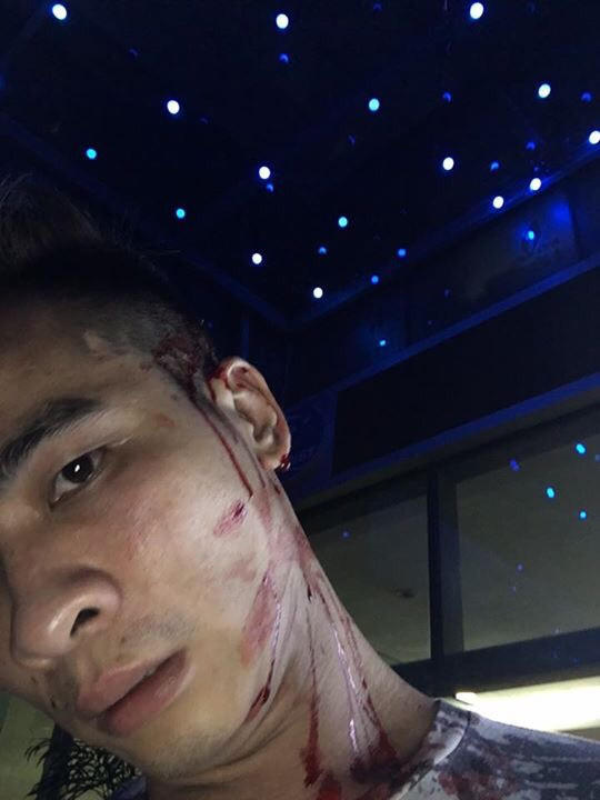 Bar Q Club chứa hung khí nóng, chém nhiều khách nhập viện?