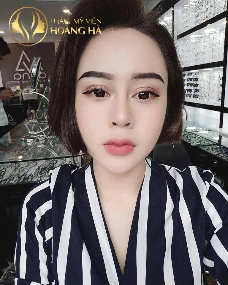 Quá trình “chiến đấu” với Silicone công nghiệp