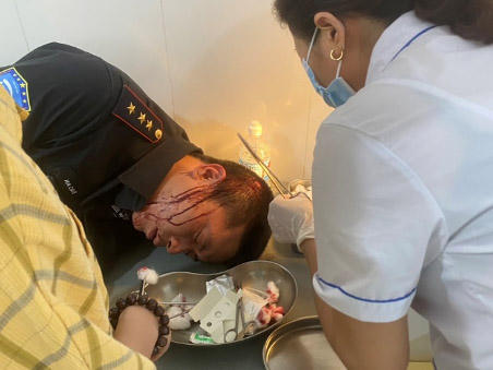 Hà Nội: Công an đang tiến hành xác minh nhóm đối tượng xông vào trụ sở công ty hành hung nhân viên