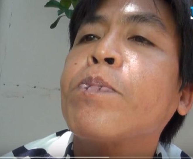 Bí quyết khỏe mạnh kỳ lạ của “dị nhân” nghiện ăn đinh suốt 30 năm