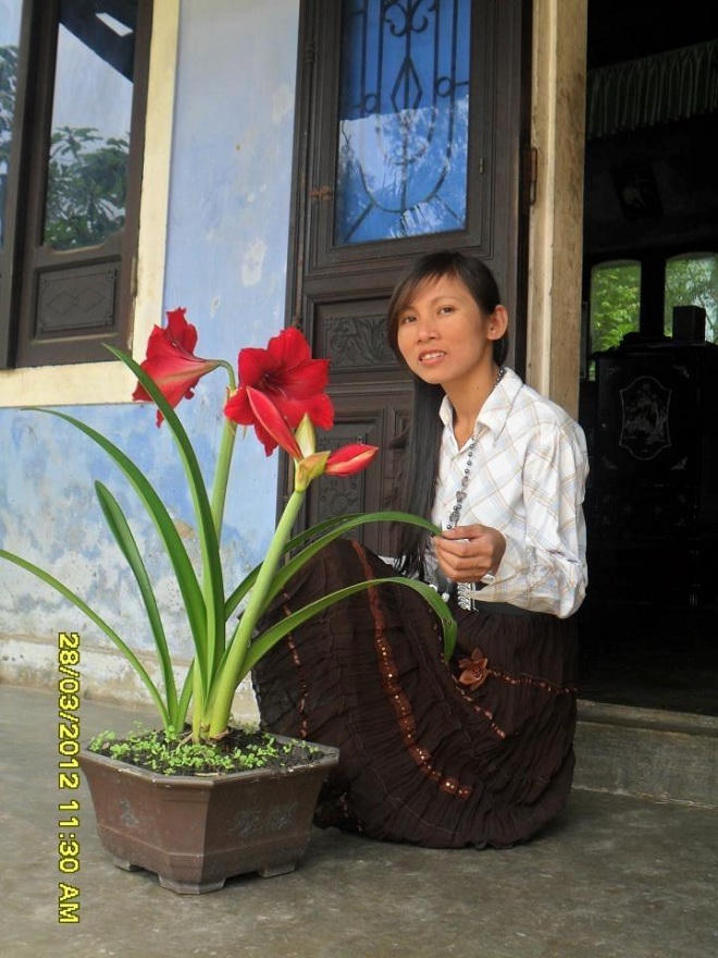 Nghị lực phi thường của cô gái suy thận giai đoạn cuối