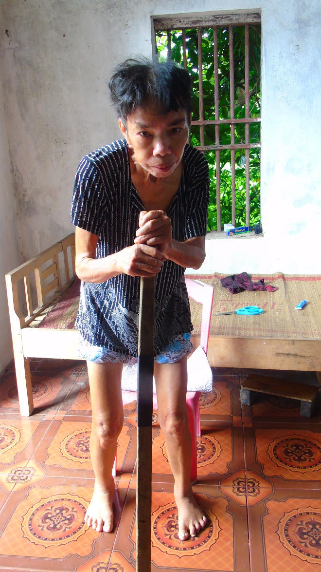 Người đàn bà mang bệnh quái ác: không ai chạm vào là co cứng ngã ngửa