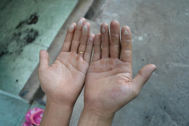 Nạn nhân kể phút 'chiến đấu với tử thần' trong phòng trọ khóa trái cửa