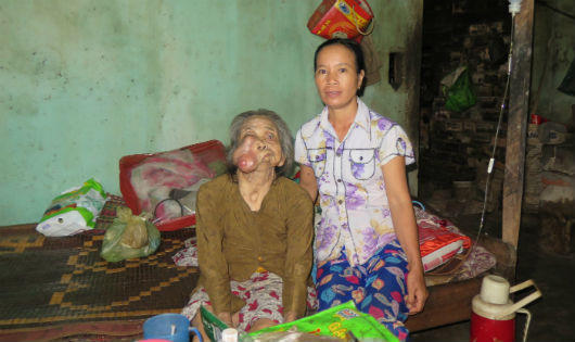 Chuyện tình đẫm nước mắt của người đàn bà đẹp bị 'giời đày'