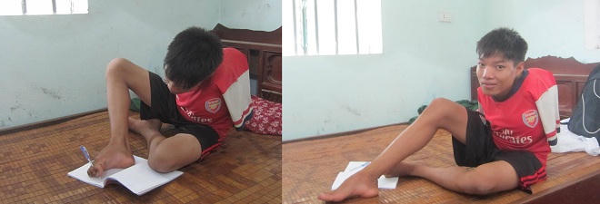 Chàng sinh viên không tay khiến bố mẹ cũng phải cảm phục